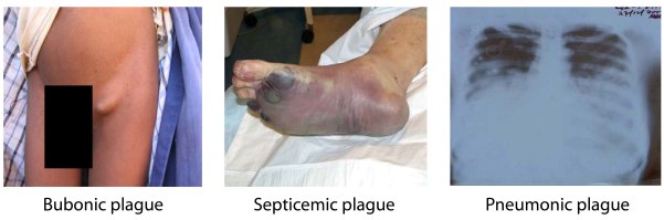 Example of plague symptoms